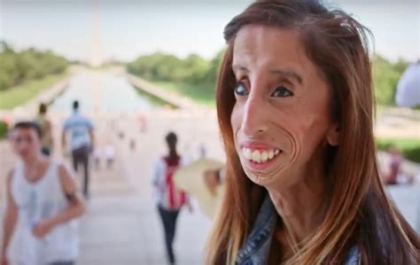 ugly blonde people|She Was Once Called the World’s Ugliest Woman—Now She’s.